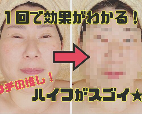 ブルーハンズ