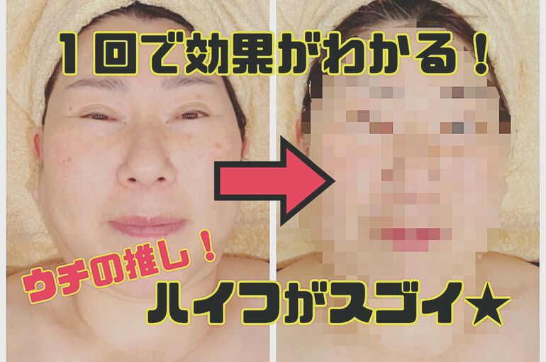 ブルーハンズ