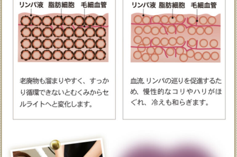ブルーハンズ